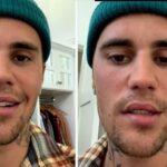 Justin Beiber says right side of his face is paralysed after virus attack