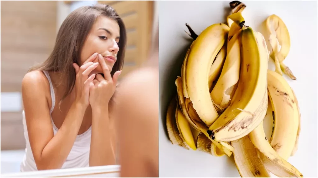 banana-peel