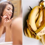 banana-peel