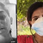Young woman from Mumbai attacked while performing Giriraj Parikrama