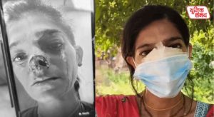 Young woman from Mumbai attacked while performing Giriraj Parikrama